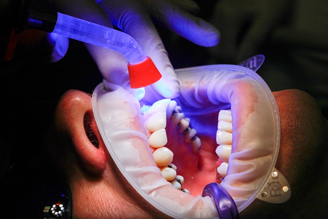 Czy chirurgia stomatologiczna jest bolesna? Mierzymy się z mitami